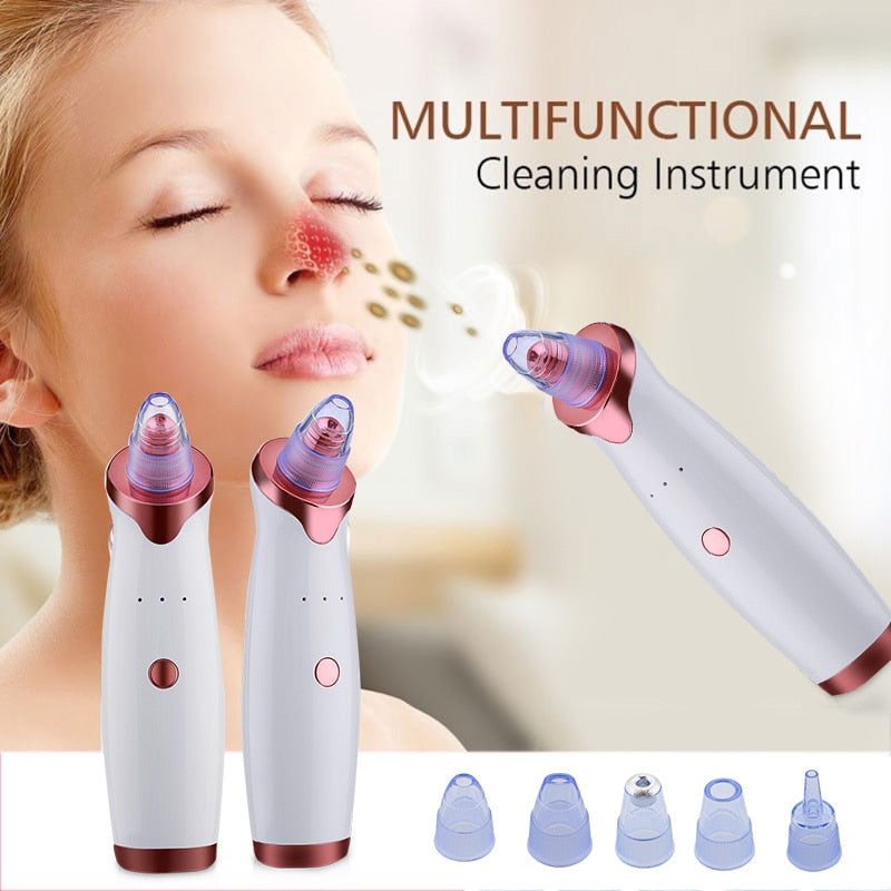 Electric Blackhead Remover