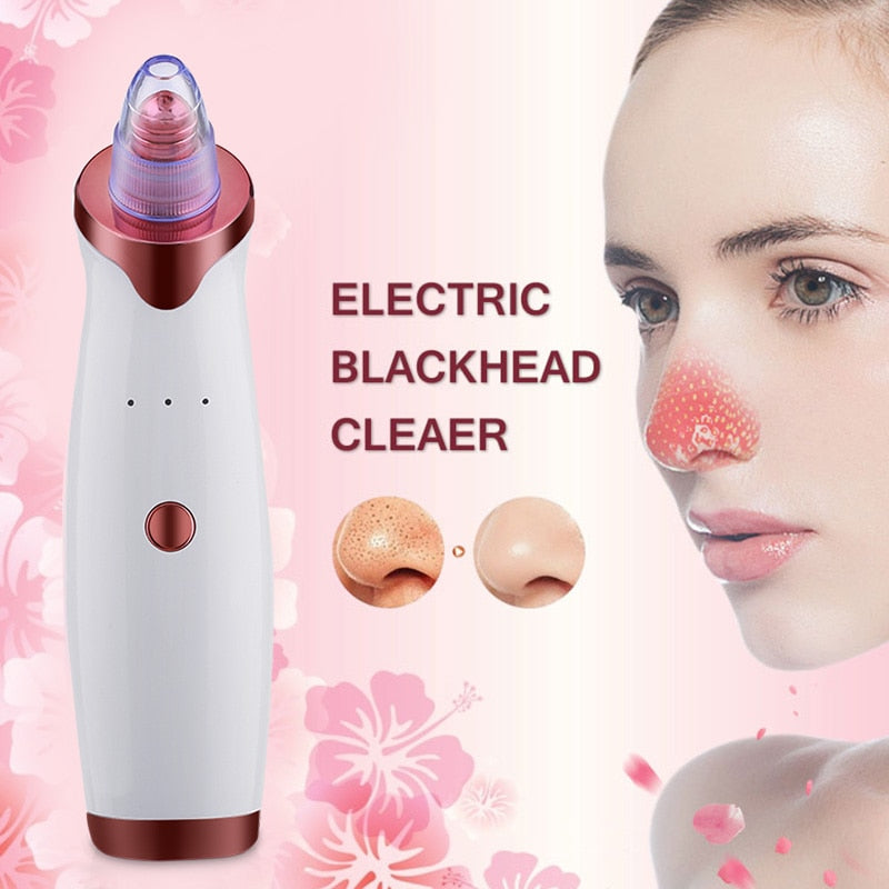 Electric Blackhead Remover