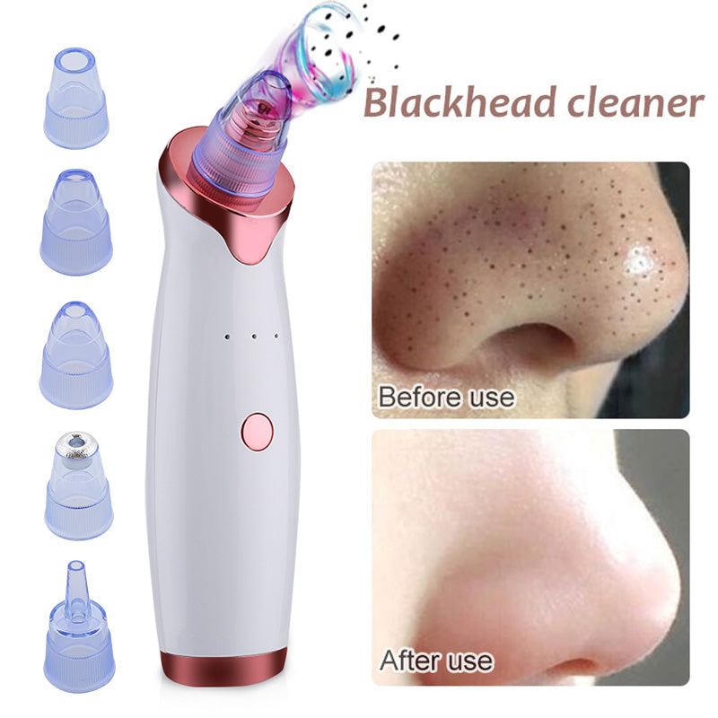 Electric Blackhead Remover