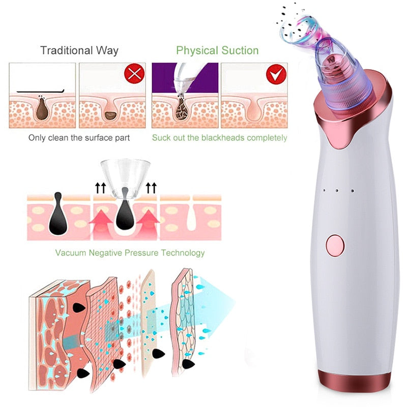 Electric Blackhead Remover