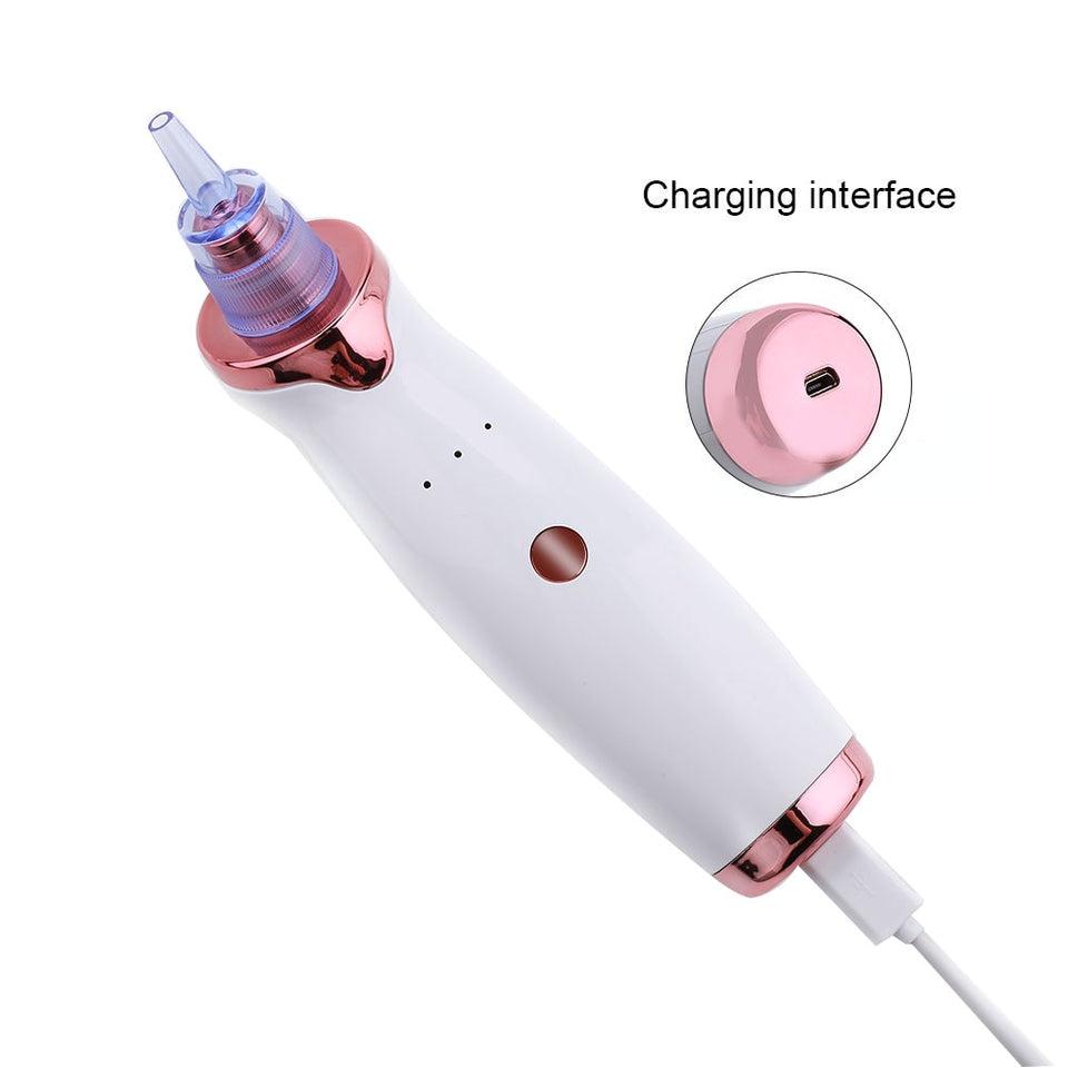 Electric Blackhead Remover